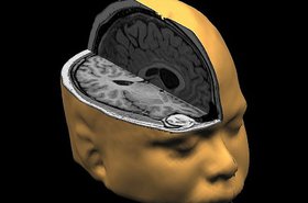 brain.jpg